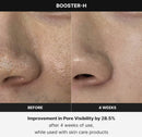Medicube Age-R Booster H