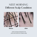 GROWUS Damage Therapy Scalp Scaling Ampoule 50ml / 1.69 fl. oz.