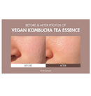 Vegan Kombucha Tea Essence 5.07 fl.oz. / 150ml