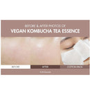 Vegan Kombucha Tea Essence 5.07 fl.oz. / 150ml