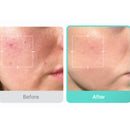 Medicube Azelaic Acid 16 BB Calming Serum